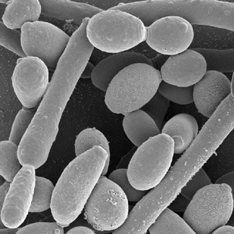 Candida: sintomi e cura convenzionale