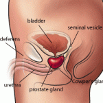 Prostata: quante biopsie inutili a causa del PSA?