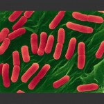 Epidemia da escherichia coli in Germania: ceppo mutato?