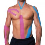 Kinesio taping, il cerotto colorato che allevia i dolori muscolari